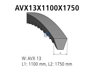DT V-BELT KIT 2